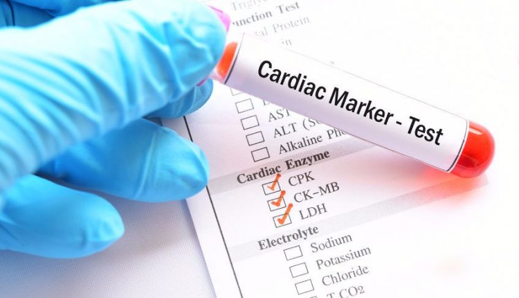 آنزیم های قلبی