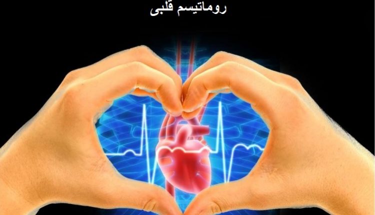 روماتیسم قلبی