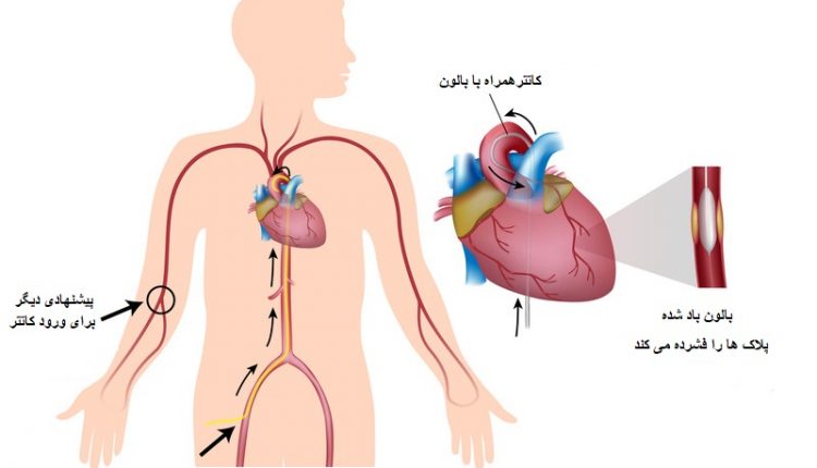 بالون قلب