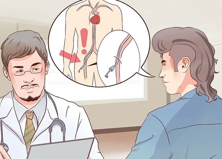 مراقبت بعد از آنژیوگرافی - دستورات پزشک