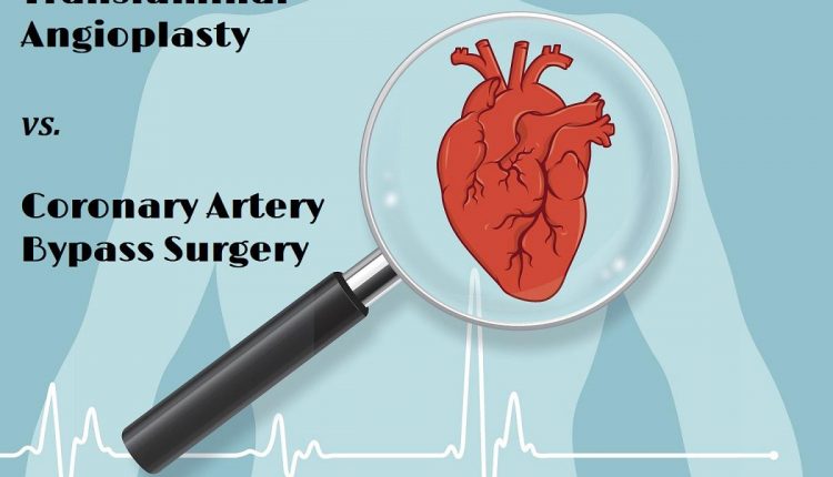 مقایسه آنژیوپلاستی و عمل قلب باز