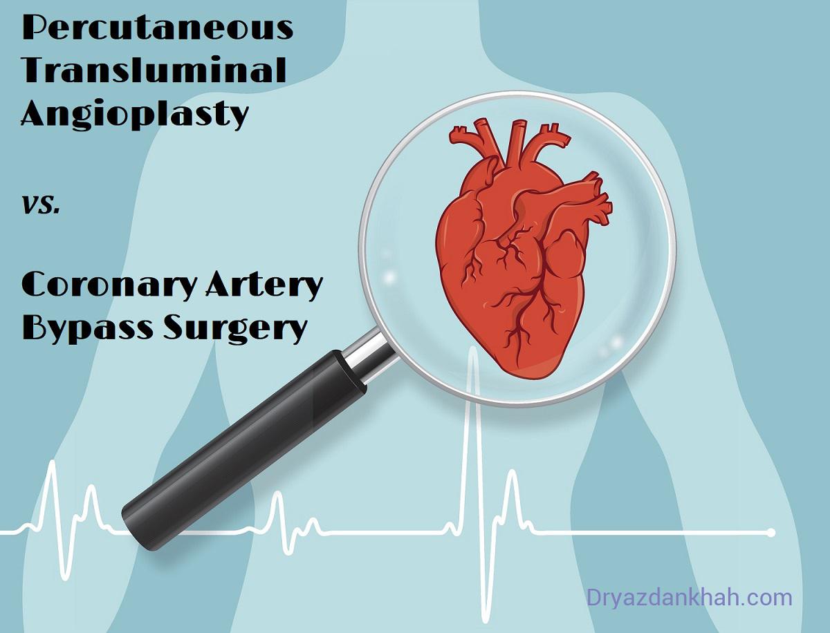 مقایسه آنژیوپلاستی و عمل قلب باز